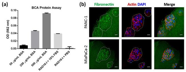 Fibronectin Antibody in Immunocytochemistry (ICC/IF)