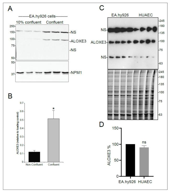 ALOXE3 Antibody in Western Blot (WB)