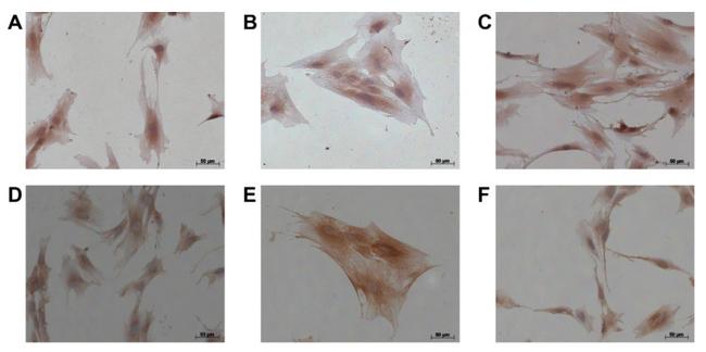 Alpha-Smooth Muscle Actin Antibody in Immunocytochemistry (ICC/IF)