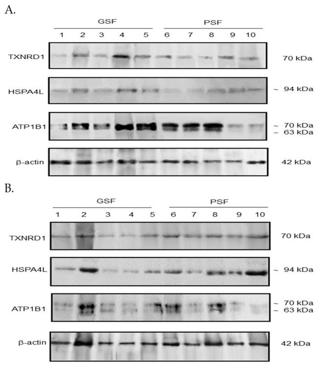 TrxR1 Antibody in Western Blot (WB)