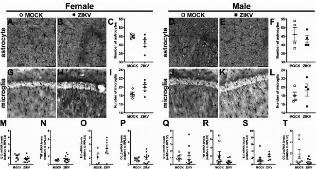 IBA1 Antibody in Immunohistochemistry (IHC)