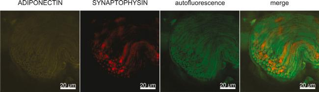 Adiponectin Antibody in Immunohistochemistry (IHC)