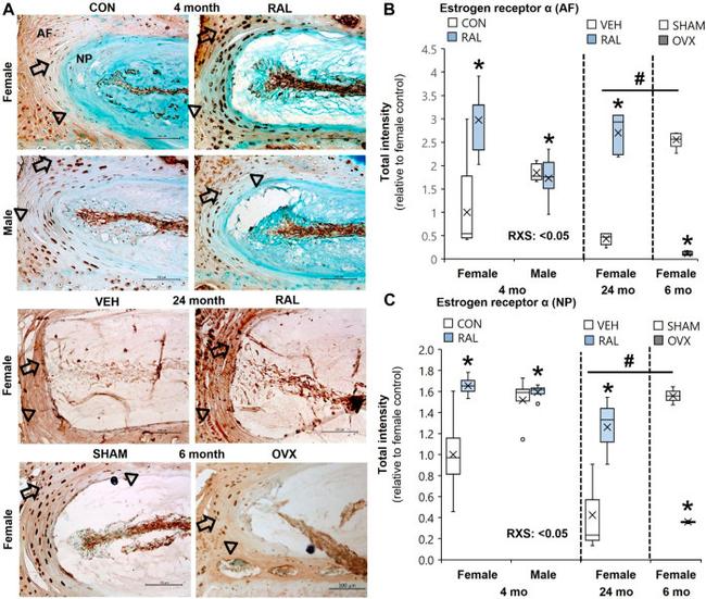 Estrogen Receptor alpha Antibody in Immunohistochemistry (IHC)