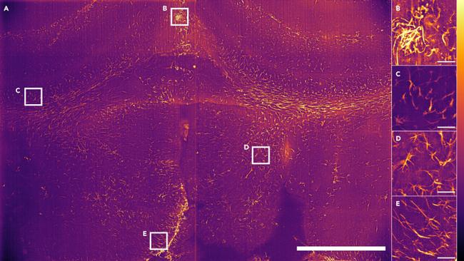 GFAP Antibody in Immunohistochemistry (IHC)