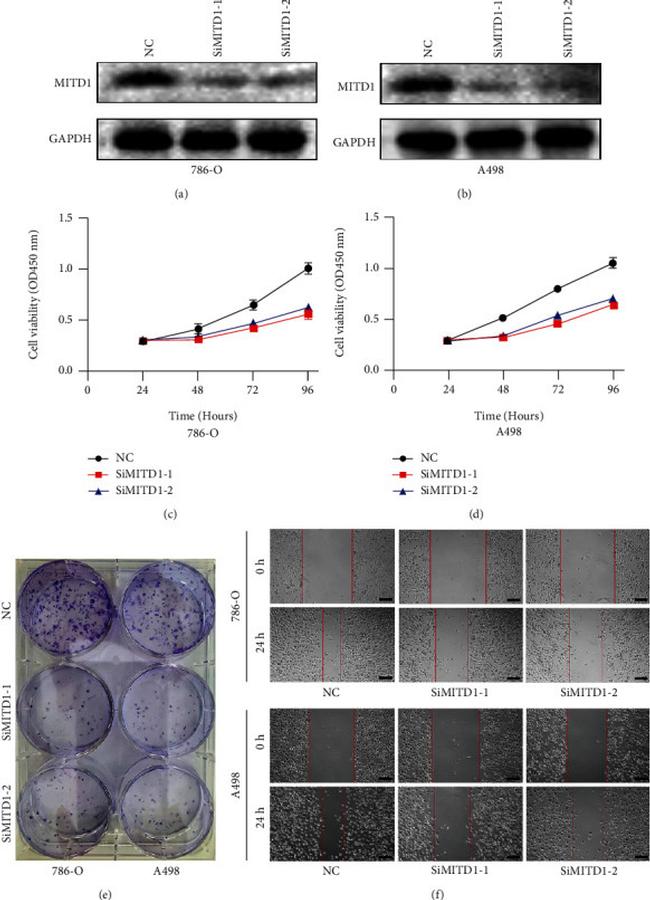 MITD1 Antibody in Western Blot (WB)