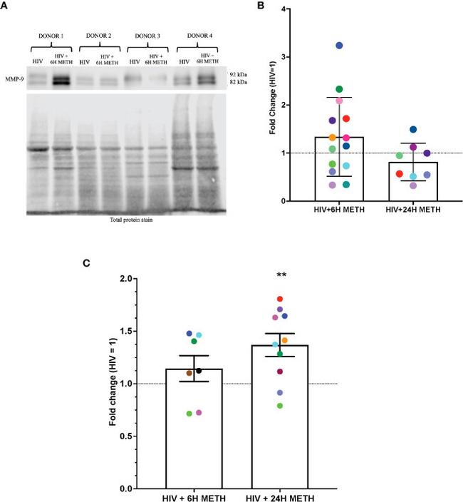 MMP9 Antibody in Western Blot (WB)