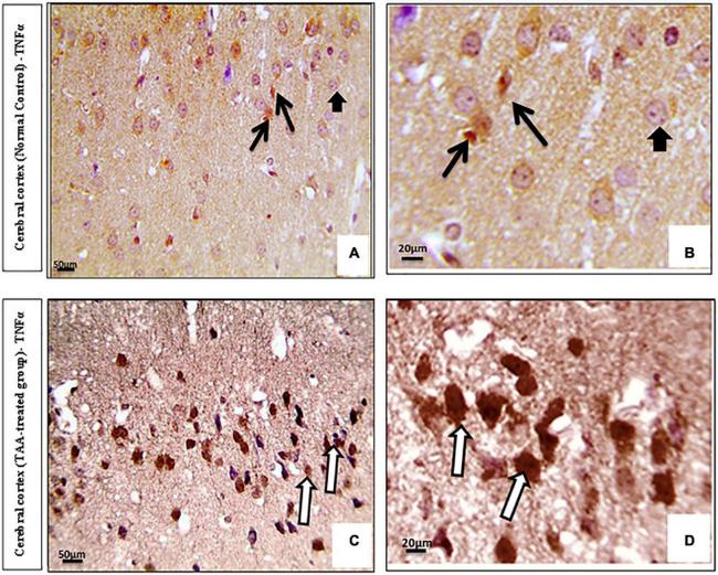 TNF alpha Antibody in Immunohistochemistry (IHC)