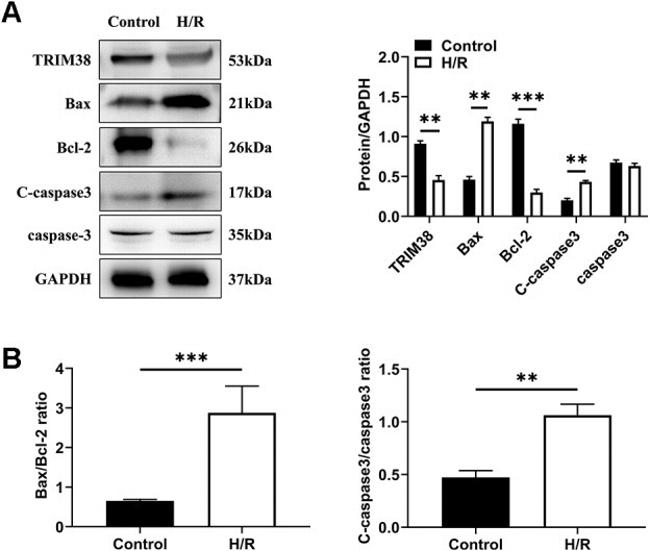 TRIM38 Antibody in Western Blot (WB)