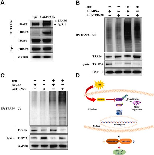 TRIM38 Antibody in Western Blot (WB)