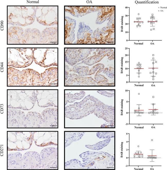 CD271 (NGF Receptor) Antibody in Immunohistochemistry (IHC)