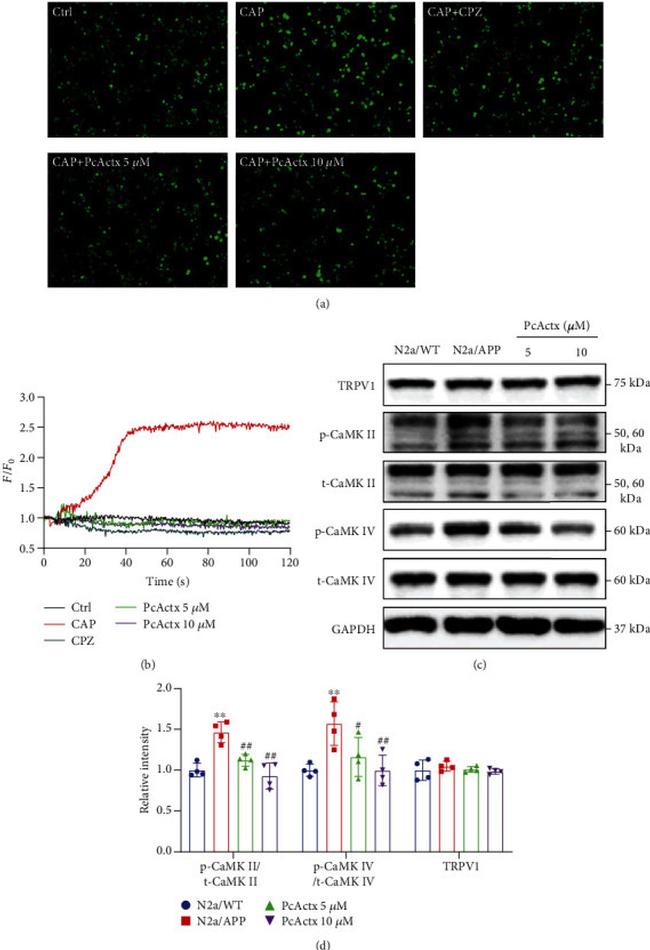 Phospho-CaMKII beta/gamma/delta (Thr287) Antibody in Western Blot (WB)