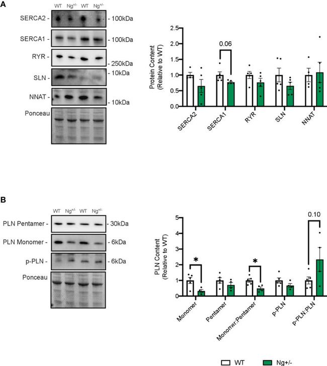 SERCA2 ATPase Antibody in Western Blot (WB)