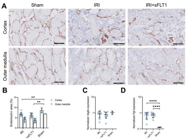 Endomucin Antibody in Immunohistochemistry (IHC)