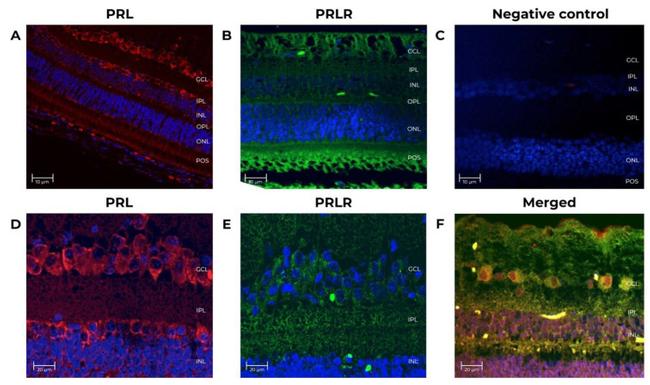 Prolactin Receptor Antibody in Immunohistochemistry (IHC)