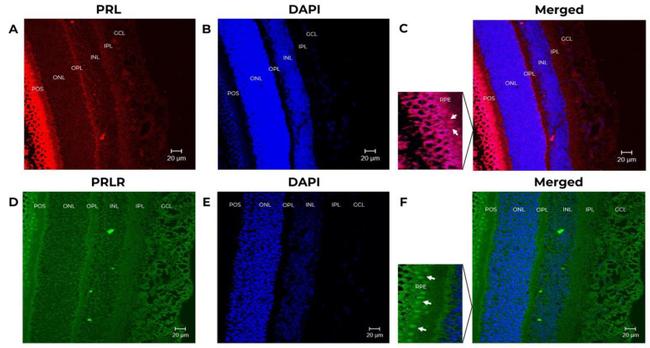 Prolactin Receptor Antibody in Immunohistochemistry (IHC)