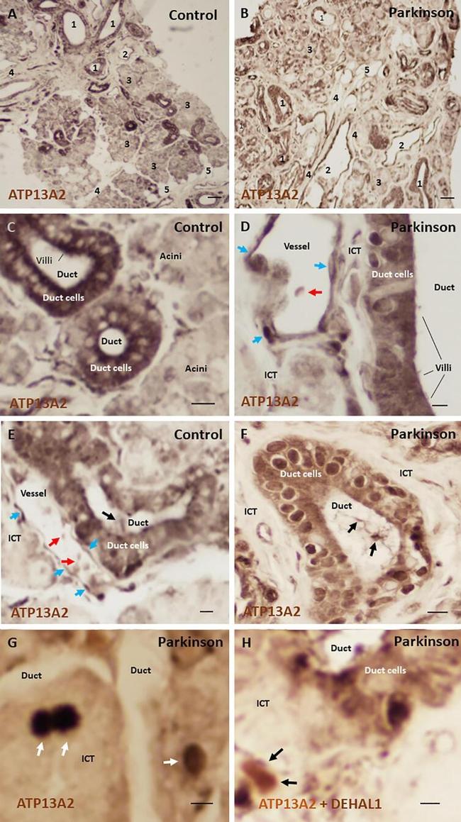 IYD Antibody in Immunohistochemistry (IHC)