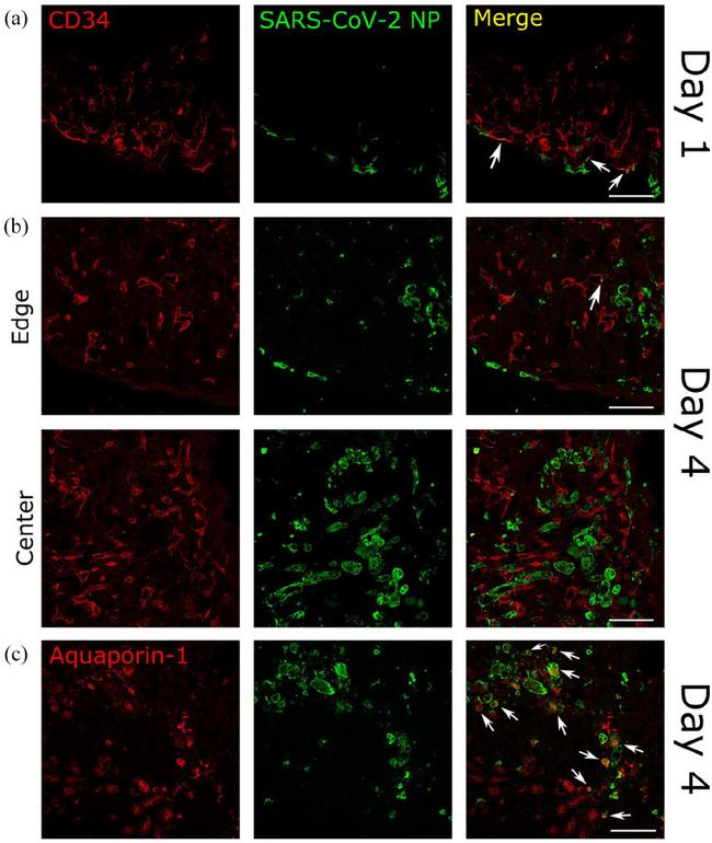 Aquaporin 1 Antibody in Immunohistochemistry (PFA fixed) (IHC (PFA))