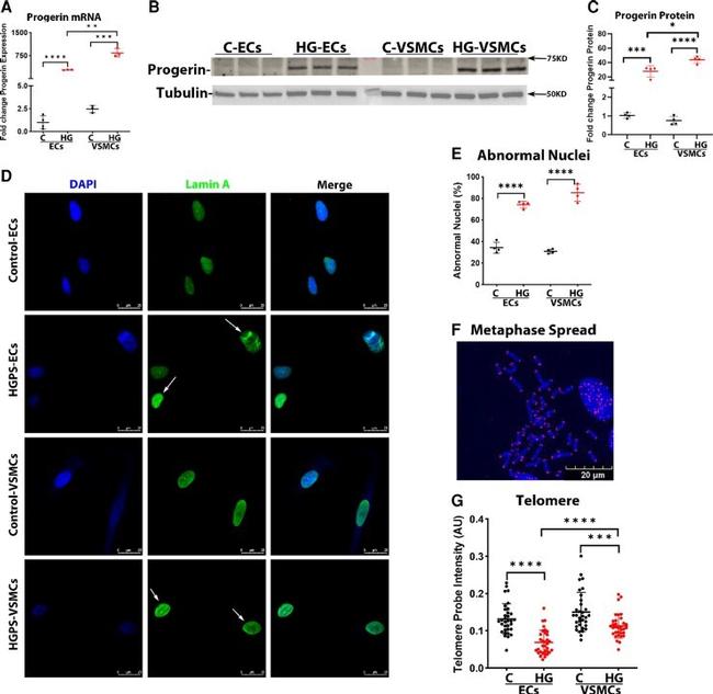 Lamin A Antibody in Immunocytochemistry (ICC/IF)