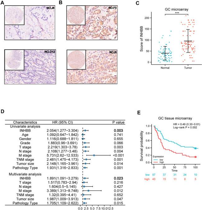 INHBB Antibody in Immunohistochemistry (IHC)