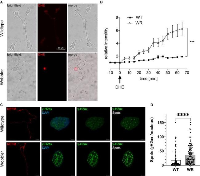 NEFM Antibody in Immunocytochemistry (ICC/IF)