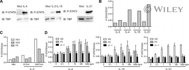 STAT6 Antibody in Western Blot (WB)