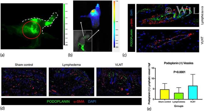 Podoplanin Antibody in Immunohistochemistry (IHC)