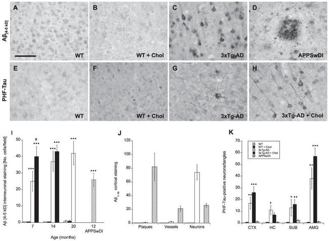 beta Amyloid Antibody in Immunohistochemistry (IHC)