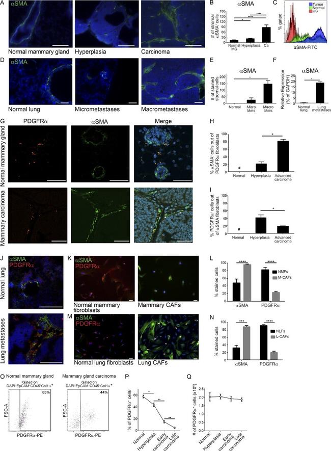 CD140a (PDGFRA) Antibody in Immunohistochemistry (IHC)