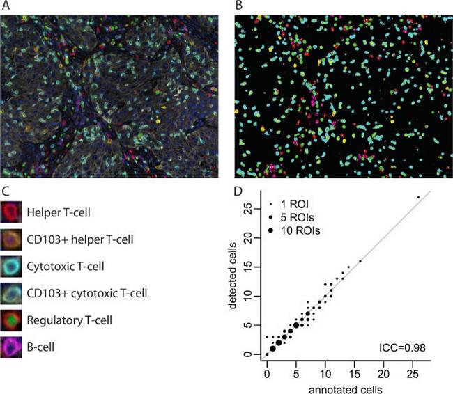 FOXP3 Antibody in Immunohistochemistry (IHC)