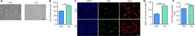 Ki-67 Antibody in Immunocytochemistry (ICC/IF)