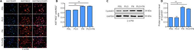 Ki-67 Antibody in Immunocytochemistry (ICC/IF)