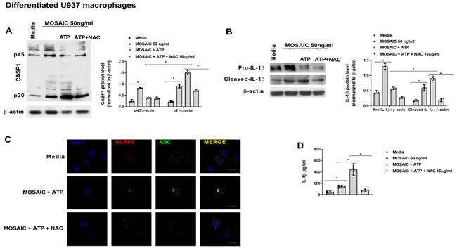 IL-1 beta (Pro-form) Antibody in Western Blot (WB)