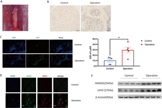 Ly-6G Antibody in Immunohistochemistry (IHC)