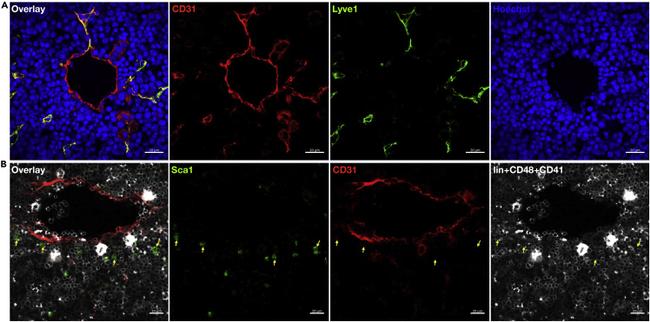 LYVE1 Antibody in Immunohistochemistry (IHC)