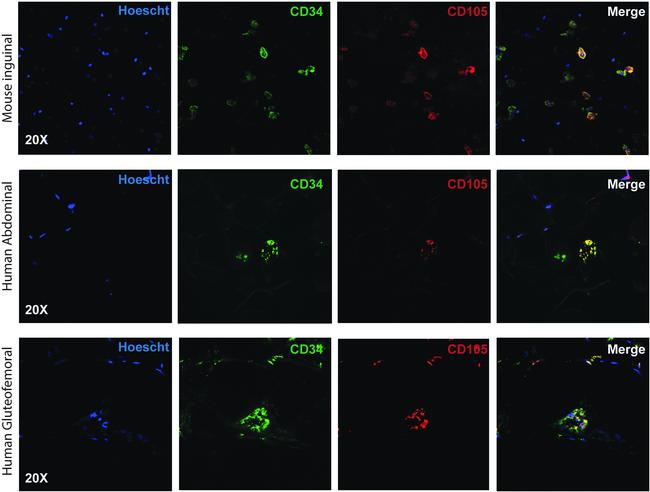 CD105 (Endoglin) Antibody in Immunohistochemistry (IHC)