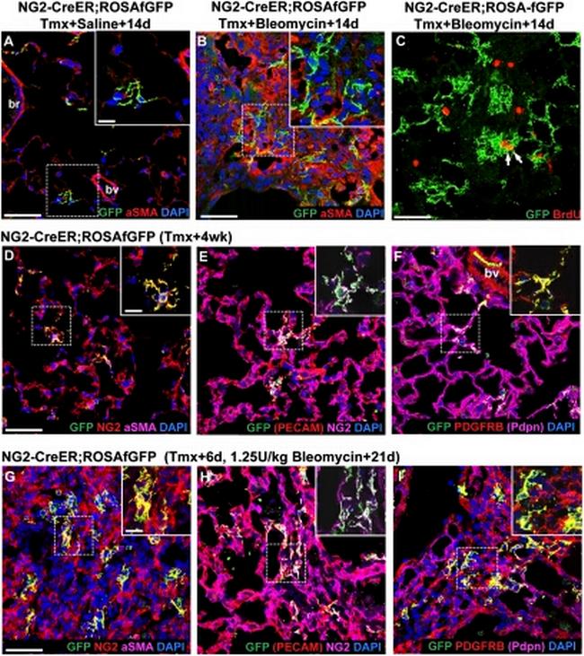 CD140b (PDGFRB) Antibody in Immunocytochemistry (ICC/IF)