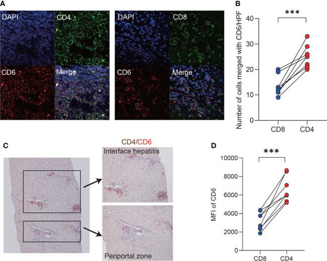 CD4 Antibody in Immunohistochemistry (IHC)