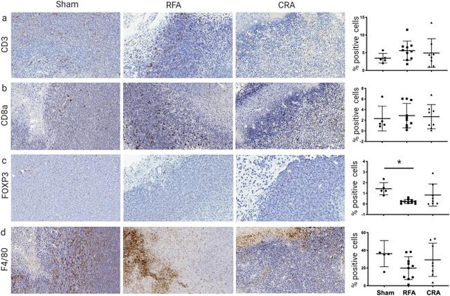 FOXP3 Antibody in Immunohistochemistry (IHC)