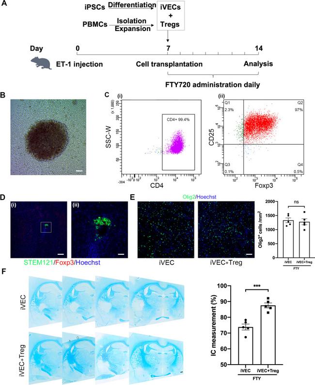 FOXP3 Antibody in Immunocytochemistry, Immunohistochemistry (ICC/IF, IHC)