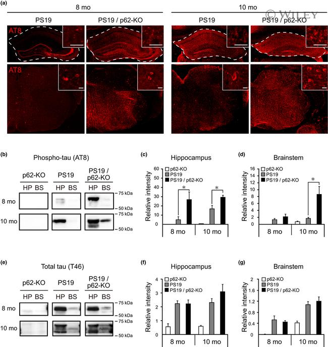 Tau Antibody in Immunohistochemistry (IHC)