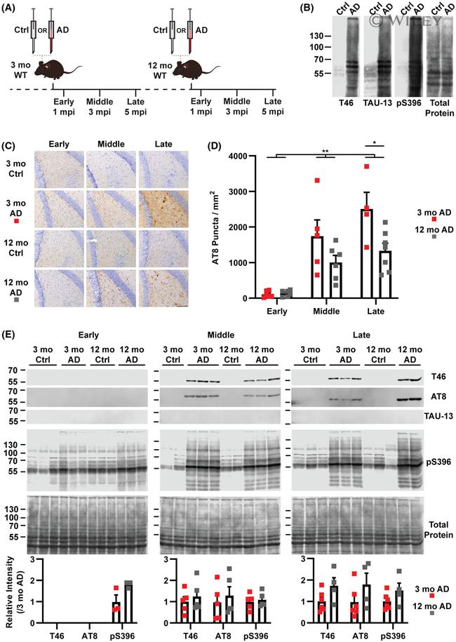 Tau Antibody in Western Blot (WB)