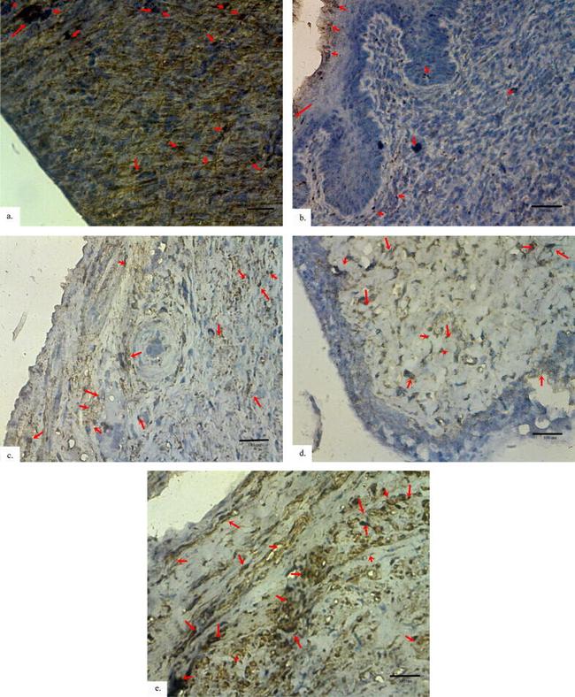 IL-10 Antibody in Immunohistochemistry (IHC)