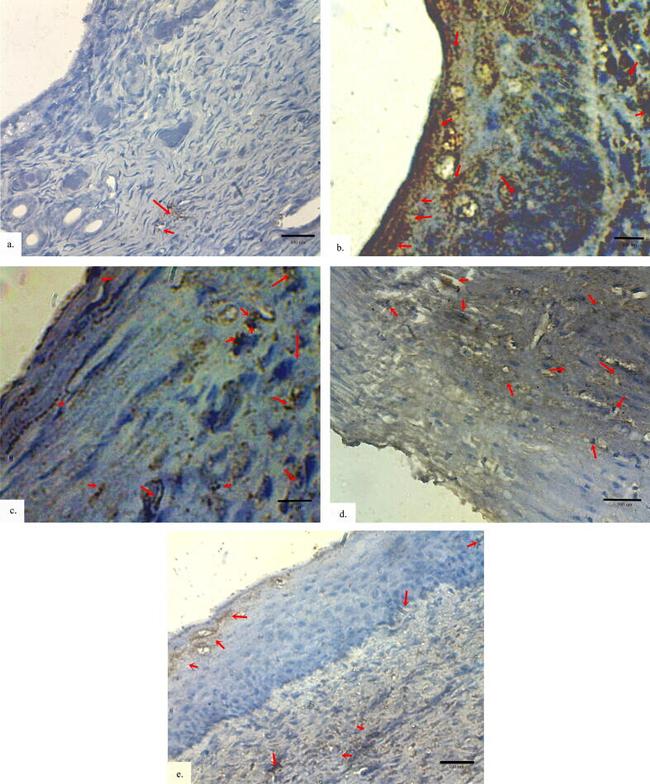 TGF beta-1 Antibody in Immunohistochemistry (IHC)