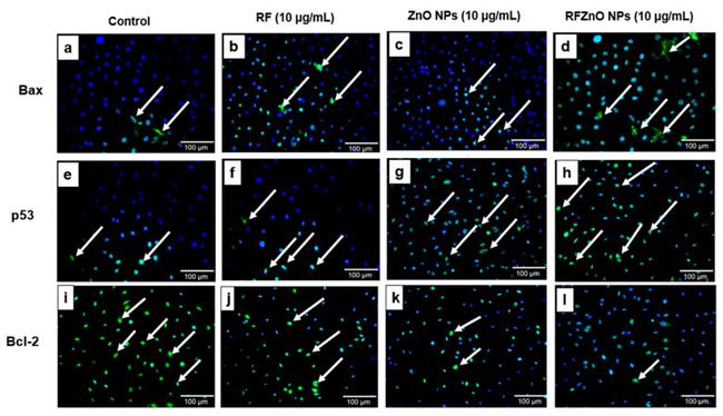 Bcl-2 Antibody in Immunocytochemistry (ICC/IF)