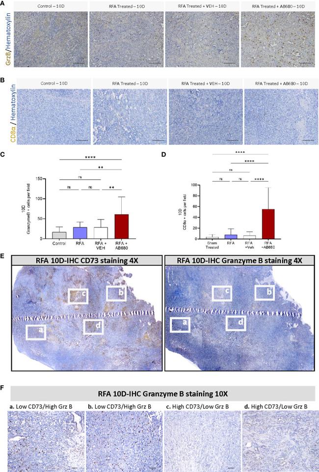 Granzyme B Antibody in Immunohistochemistry (IHC)