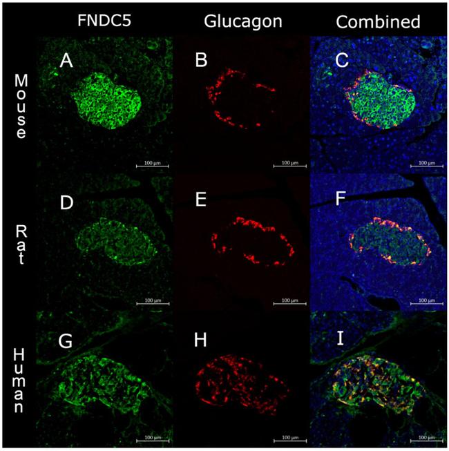 Glucagon Antibody in Immunohistochemistry (IHC)