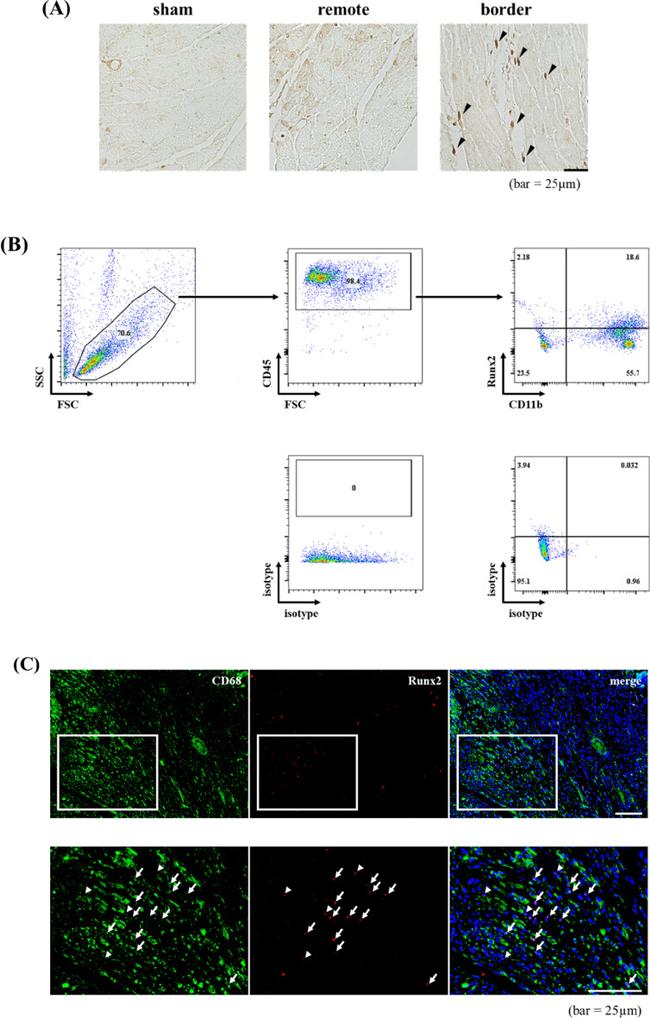 CD68 Antibody in Immunohistochemistry (IHC)