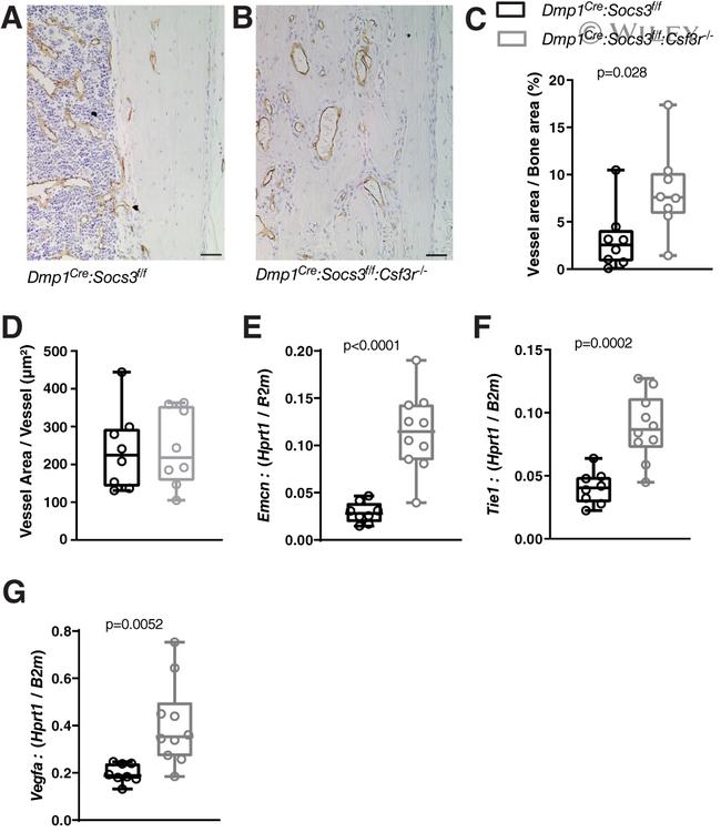 Endomucin Antibody in Immunohistochemistry (IHC)