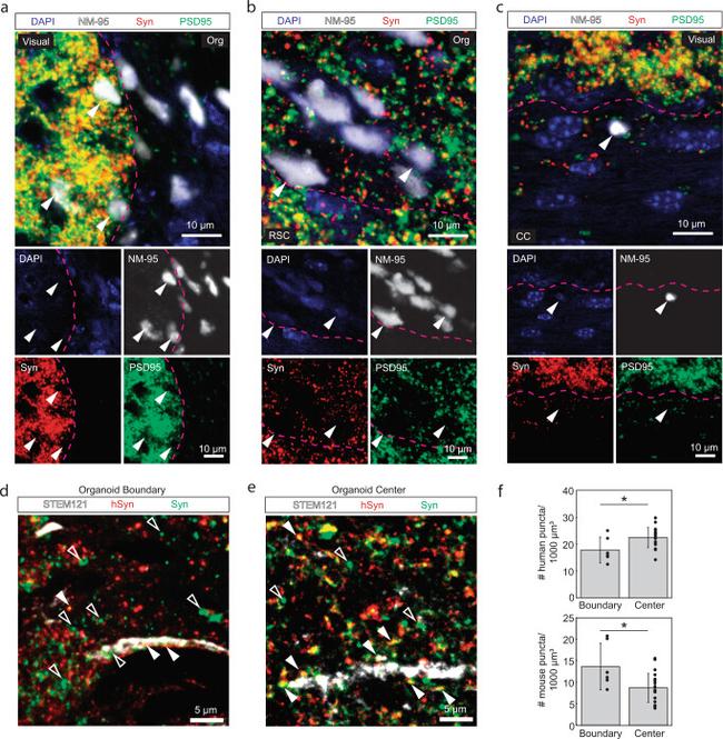 Synaptophysin Antibody in Immunohistochemistry (IHC)