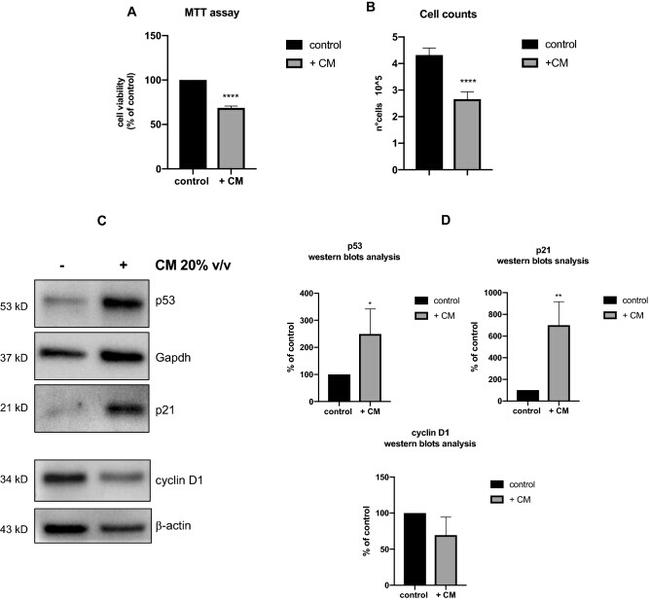 Cyclin D1 Antibody in Western Blot (WB)